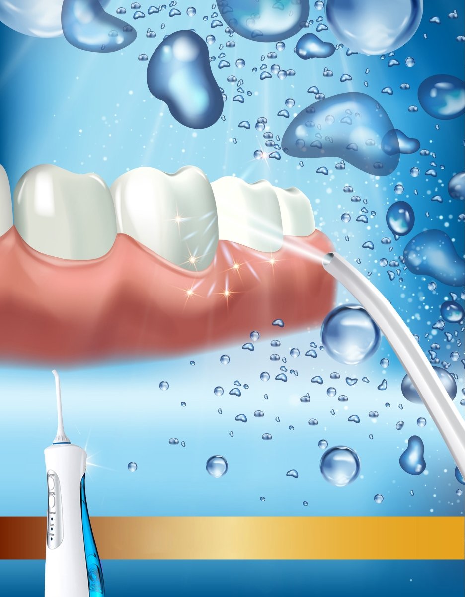 Irrigador bucal portátil - Irrigador dental agua presión quita sarro 3 modos limpieza dental - Limpieza bucal sarro dental - movilcom.com
